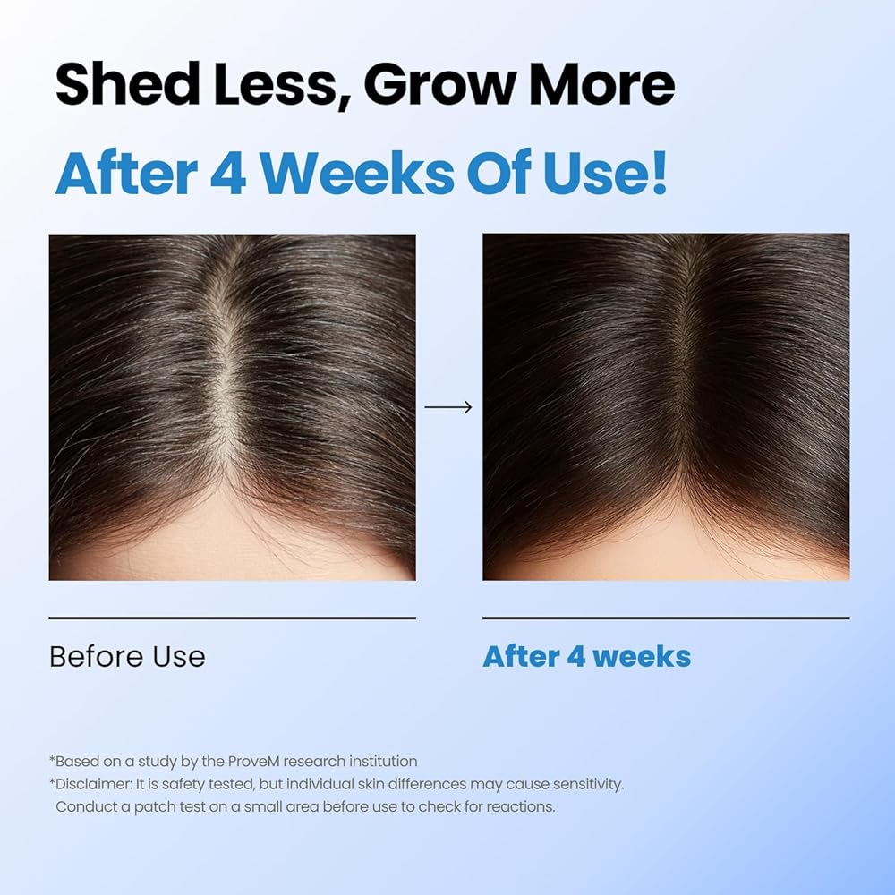 Scalpy Hair Growth Serum for Men & Women for Hair Loss & Thinning